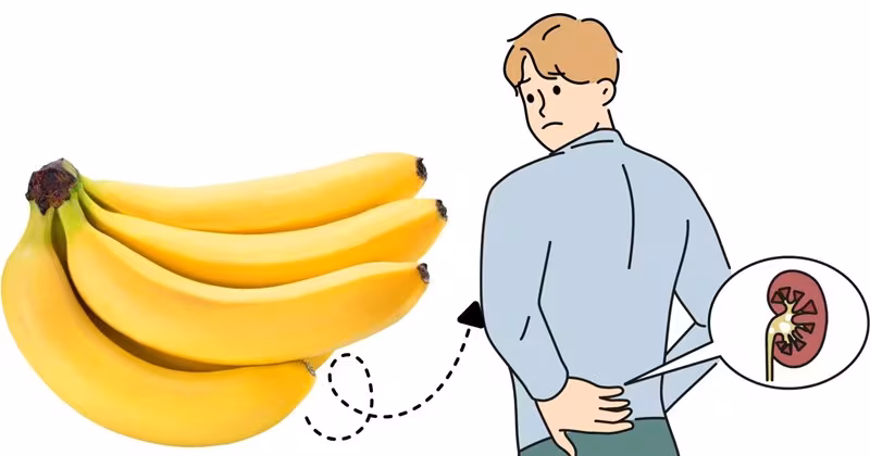Cách ăn chuối để tốt cho thận của người bệnh tiểu đường