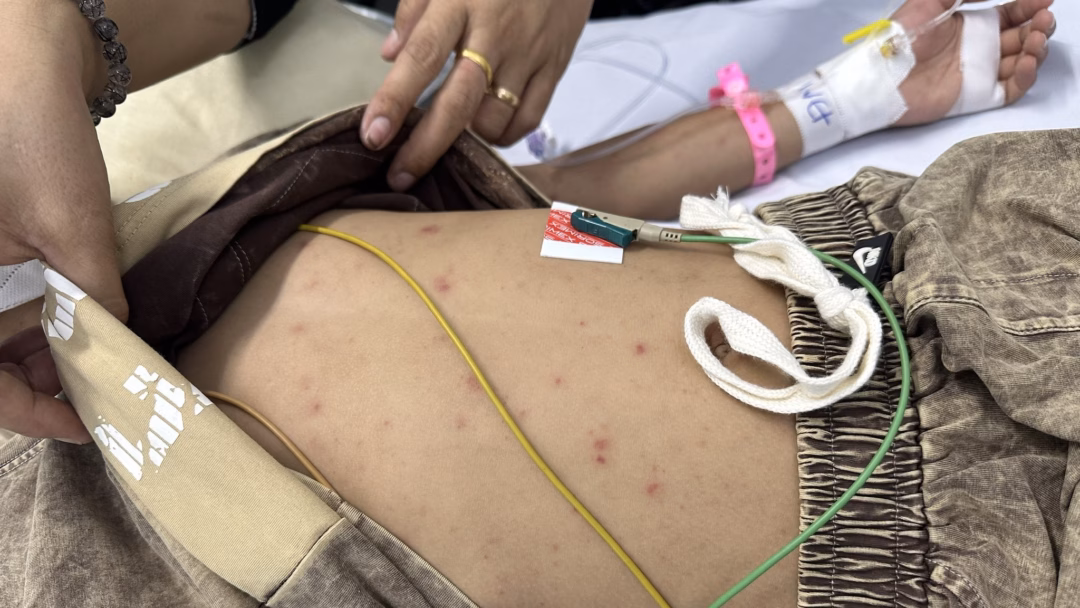 Can thiệp y tế kịp thời là yếu tố sống còn đối với bệnh nhi nhiễm não mô cầu.