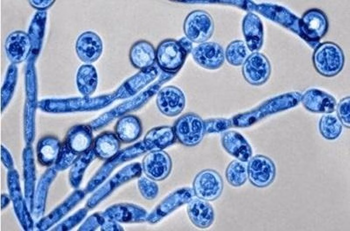 Nấm Candida vốn tồn tại tự nhiên nhưng sẽ bùng phát mạnh mẽ khi hệ miễn dịch cơ thể suy giảm. Ảnh: Nutriciologist.